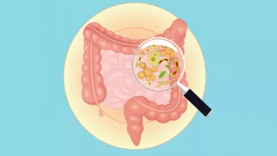 بكتيريا الاي كولاي (E.coli)
